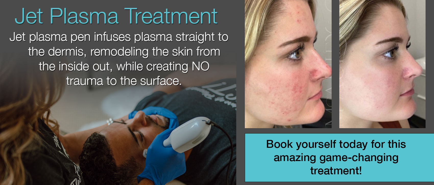 Jet plasma Treatment description and before and after